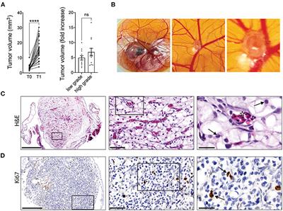 Establishment of a ccRCC patient-derived chick chorioallantoic membrane model for drug testing